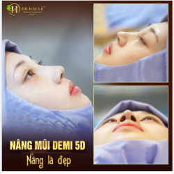 Cách để tạo ra 1 dáng mũi đẹp chuẩn TỶ LỆ VÀNG