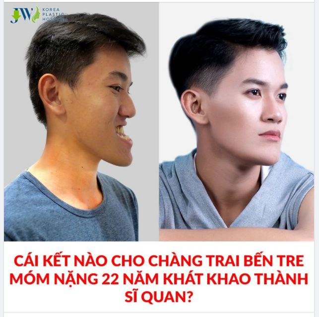 CÁI KẾT cho chàng SĨ QUAN Bến Tre được ví như HẬU DUỆ MẶT TRỜI hậu phẫu thuật HÀM MÓM