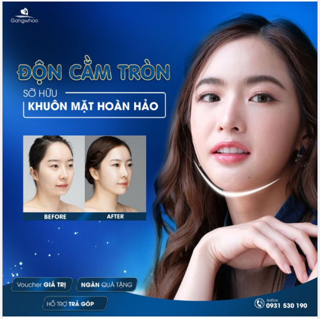 CẰM TRÒN PHÚC HẬU – ĐÓN NGAY TÀI LỘC