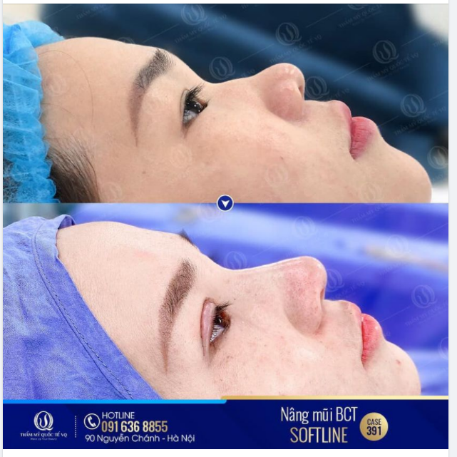 CASE 391 CÔ GÁI SINH NĂM 2000 QUYẾT TÂM TÁI TẠO NHAN SẮC, THAY ĐỔI ÁNH NHÌN