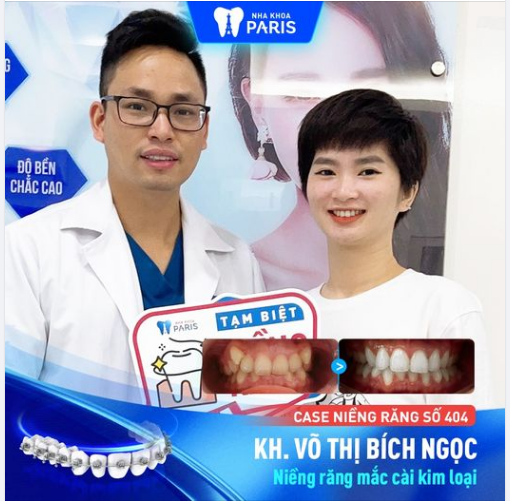 Case Niềng Răng Số 404 - Răng Đều Tăm Tắp Là Hàng Mỹ Nhân