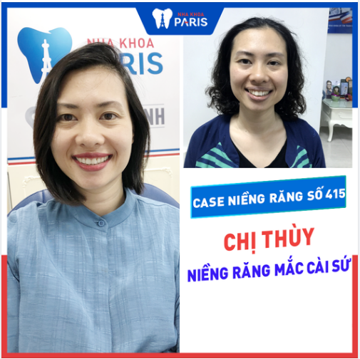 Case Niềng Răng Số 415 - Lấy Lại Tuổi Thanh Xuân