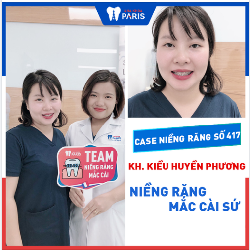 Case Niềng Răng Số 417 - U30 Niềng Răng Vẫn Chưa Muộn!