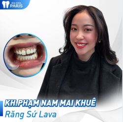 Case Răng Sứ Số 354 - Rạng Ngời Răng Sứ Lava Cao Cấp