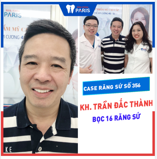 Case Răng Sứ Số 356 - Nụ Cười Lịch Lãm Tuổi Trung Niên