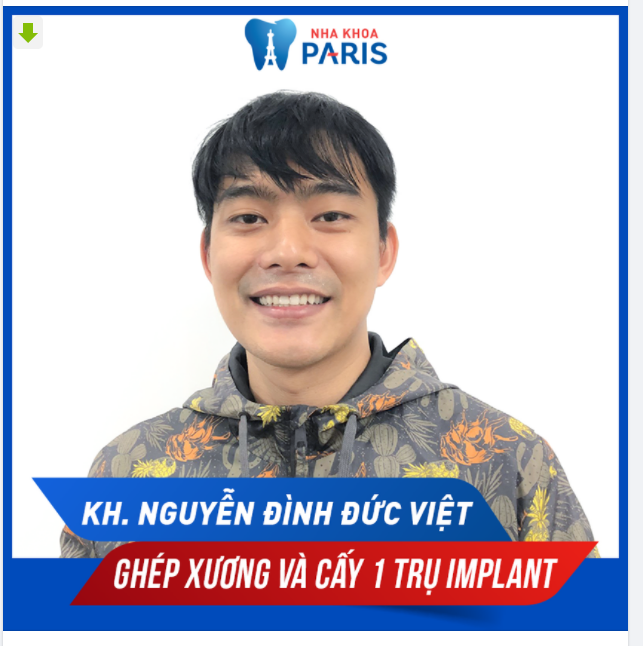 Case Trồng Răng Số 344 - Hoàn Thiện Nụ Cười Nam Tính