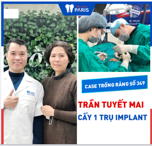 Case Trồng Răng Số 349