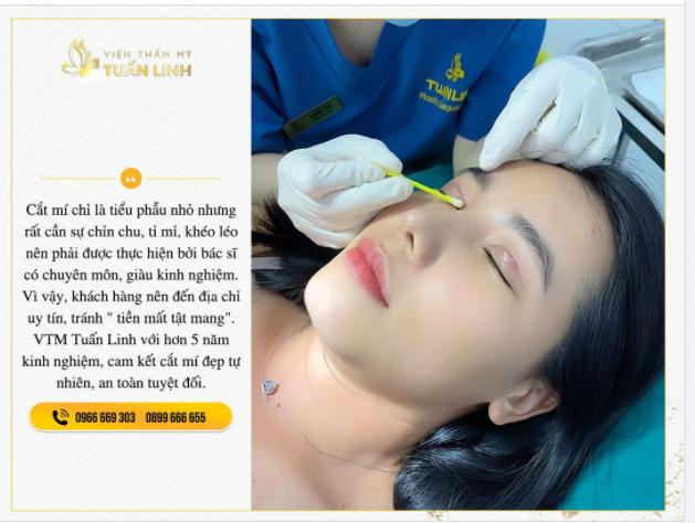 CẮT MÍ NHẤT ĐỊNH PHẢI LỰA CHỌN MỘT ĐỊA CHỈ UY TÍN.