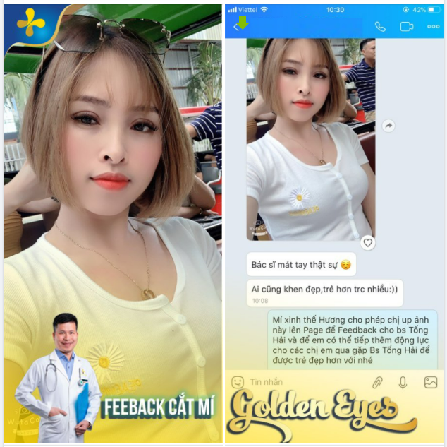 Cắt mí xong “ai cũng khen trẻ và đẹp hơn trước” Khách hàng nào cắt mí tại Dr.Tống Hải cũng nói câu này.