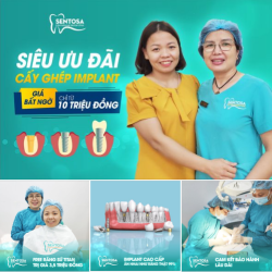 CẤY GHÉP IMPLANT  GIÁ SIÊU ƯU ĐÃI - CHỈ TỪ 10 TRIỆU ĐỒNG