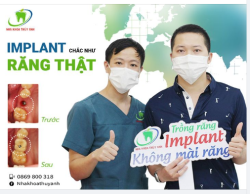CẤY GHÉP TRỤ IMPLANT, ƯU ĐÃI CHỈ TỪ 6 TRIỆU 9/RĂNG