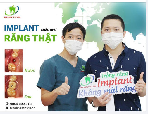 CẤY GHÉP TRỤ IMPLANT, ƯU ĐÃI CHỈ TỪ 6 TRIỆU 9/RĂNG