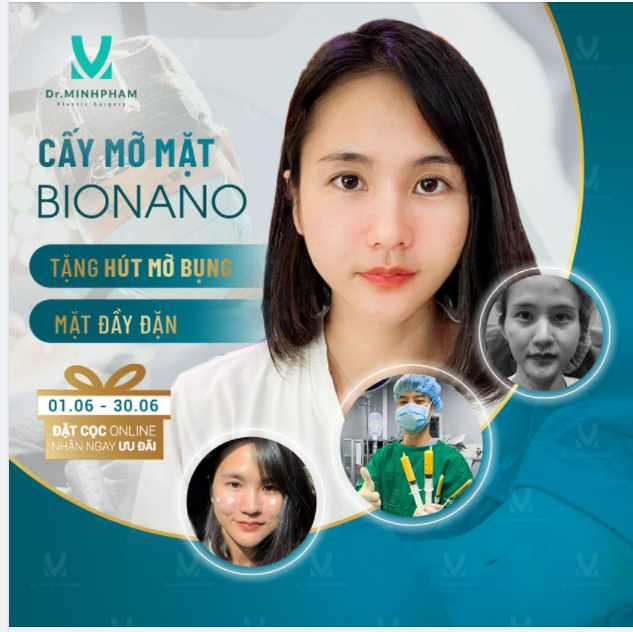 CẤY MỠ MẶT BIO NANO ĐẦY ĐẶN – CÂN ĐỐI - ĐẸP TỰ NHIÊN