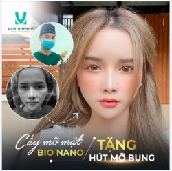 CẤY MỠ MẶT BIO NANO ĐẸP KHÔNG GÓC CHẾT TẶNG NGAY HÚT MỠ BỤNG