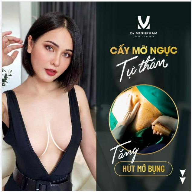 CẤY MỠ NGỰC TỰ THÂN - CĂNG ĐẦY ĐẸP TỰ NHIÊN TẶNG MIỄN PHÍ HÚT MỠ BỤNG duy nhất trong tháng 6