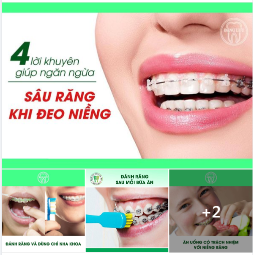 Chăm sóc răng miệng tốt khi đeo niềng là một điều vô cùng quan trọng -  cần thiết