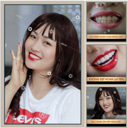 Chẳng cần tới 10 năm hay 20 năm để thay đổi, tới Smile Up, chắc chắn khách hàng sẽ lột xác ngoạn mục chỉ sau 48h làm đẹp.