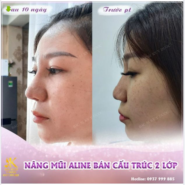 CHỈ 10 NGÀY - LÊN FORM NGAY