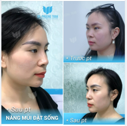 CHỈ CẦN ĐẶT SỐNG LÀ ĐỦ VỚI BẠN ẤY