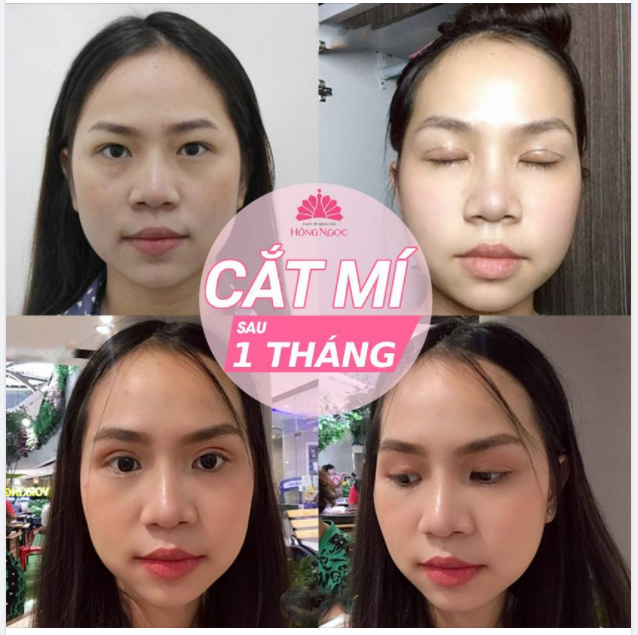 CHỈ CẮT MÍ THÔI MÀ GƯƠNG MẶT SANG LÊN BỘI PHẦN