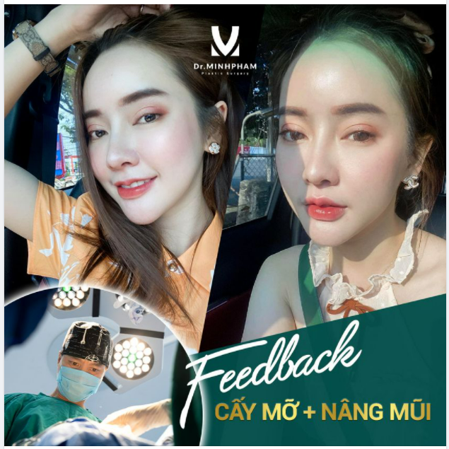 CHỈ CÓ THỂ LÀ YÊU Combo NÂNG MŨI + CẤY MỠ MẶT ĐẸP KHÔNG GÓC CHẾT