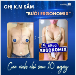 CHỊ K.M SẮM “BƯỞI ERGONOMIX” CỰC XINH CHỈ SAU 10 NGÀY