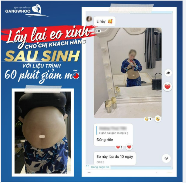 CHỊ KHÁCH GỬI NHỮNG LỜI FEEDBACK NGỌT NGÀO CÙNG VÒNG 2 LÝ TƯỞNG SAU KHI DÙNG HÚT MỠ (CÔNG NGHỆ CAO LIPO ULTRASOUND)