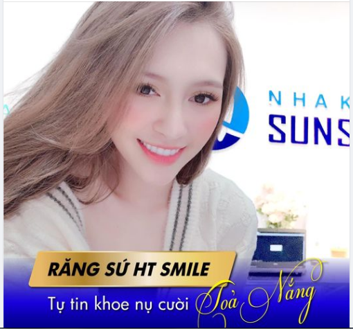 Chị Quỳnh đến với nha khoa thẩm mỹ SunShine đã chia sẻ nỗi lo lắng bấy lâu nay vì công việc của chị là người mẫu ảnh, diễn viên, KOL…