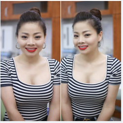 Chỉ sau 2 lần hẹn cùng chuyên gia của Nha khoa Gia Đình, chị khách đã thay đổi hoàn toàn diện mạo nụ cười của mình trở nên rạng ngời, tươi tắn