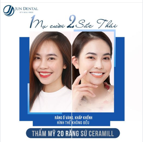 CHỈ SAU 2 NGÀY - GIẢI CỨU THÀNH CÔNG HÀM RĂNG Ố VÀNG KÉM DUYÊN