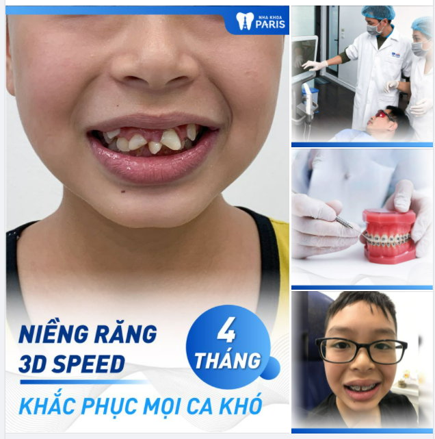 Chỉ từ 22,5TR​​​​​​​ 4 tháng kết quả rõ rệt