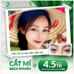 CHỈ TỪ 4.5 TRIỆU CÓ NGAY ĐÔI MẮT ĐẸP "HÚT HỒN"