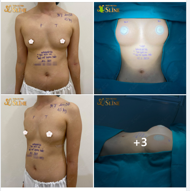 Chỉ Với 62,9 Triệu ( NGỰC ĐẸP - EO THON ) là đây...