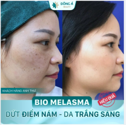 CHIA TAY NÁM SẠM - RẠNG SÁNG LÀN DA