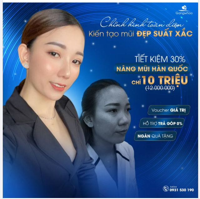 CHỈNH HÌNH TOÀN DIỆN MŨI ĐẸP XUẤT SẮC