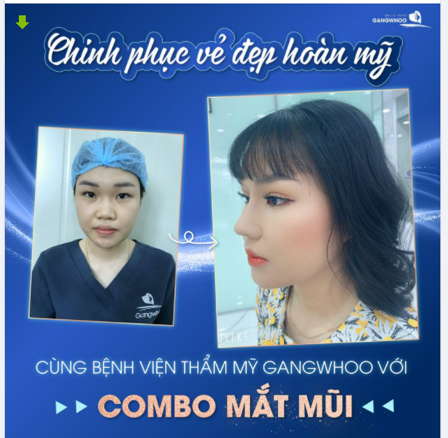 CHINH PHỤC VẺ ĐẸP HOÀN MỸ CÙNG TM GANGWHOO VỚI COMBO MẮT MŨI