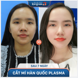 Cho chị em đang quan tâm CẮT MÍ BAO LÂU THÌ ĐẸP