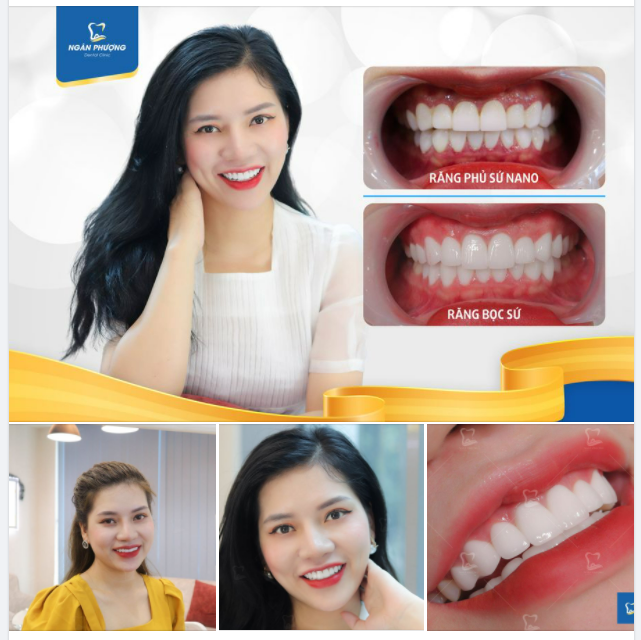 Chọn đúng phương pháp, răng bền đẹp như mơ