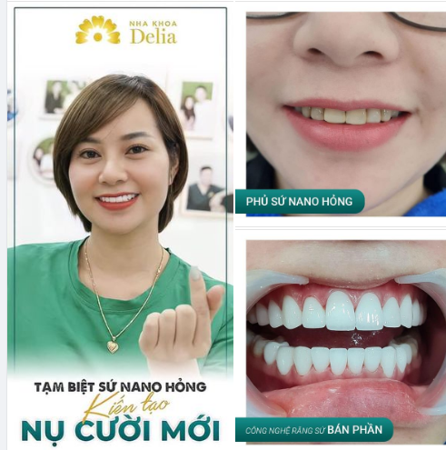CHỌN PHỦ “SỨ” NANO VÀI THÁNG ĐÃ HỎNG?