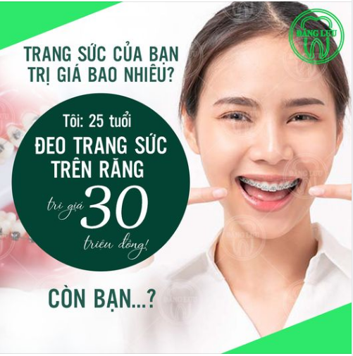 Chuyên mục đọ trang sức bắt đầu