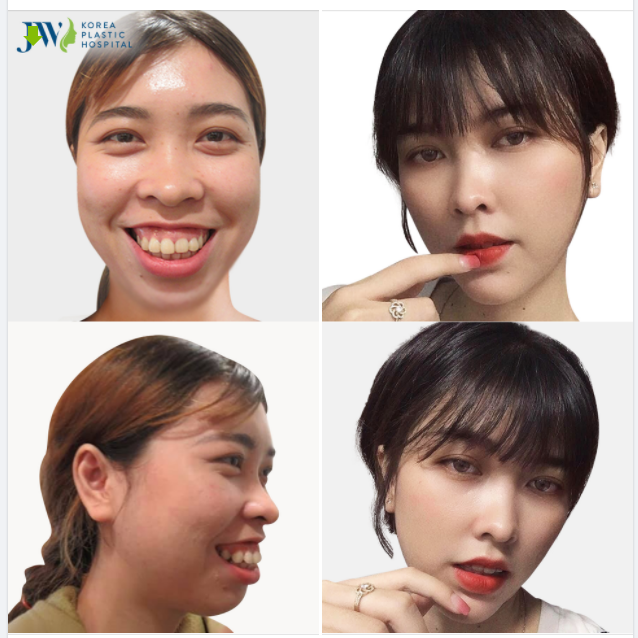 CÔ GIÁO NĂM XƯA KHÔNG CƯỜI VÌ SỢ MẤT DUYÊN GIỜ HIẾM CƯỜI VÌ SỢ ĐÁNH CẮP TRIỆU TRÁI TIM !