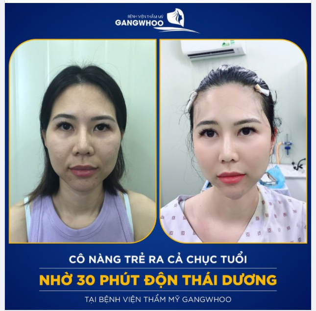 CÔ NÀNG TRẺ RA CHỤC TUỔI NHỜ 30 PHÚT ĐỘN THÁI DƯƠNG TẠI TM GANGWHOO