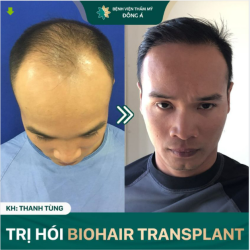 Có tóc tai 1 tí nhìn khác hẳn!