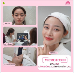 COMBO CĂNG BÓNG XÓA NHĂN ĐỈNH CAO