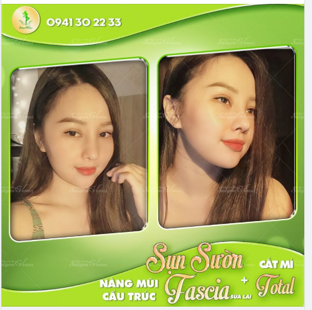 COMBO HOÀN HẢO DÀNH CHO HOTGIRL PHƯƠNG LY