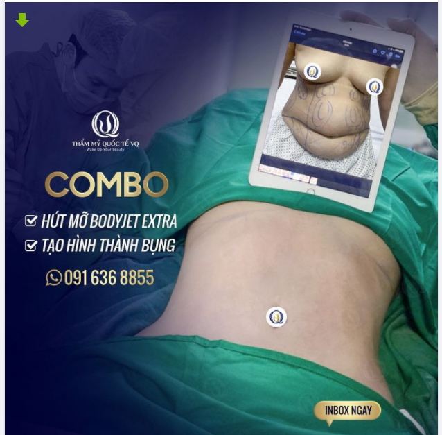Combo hút mỡ công nghệ Bodyjet Extra loại bỏ hoàn toàn mỡ thừa + tạo hình thành bụng, tái tạo đường cong eo thon như hồi còn son