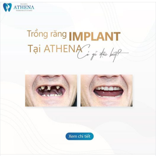 Công nghệ máy móc hiện đại, được nhập khẩu chính hãng từ Châu Âu, Châu Mỹ..