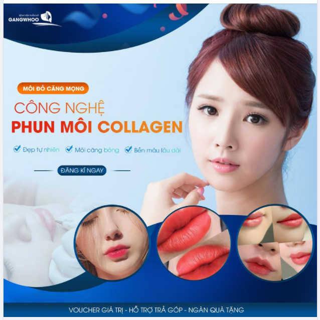 CÔNG NGHỆ PHUN MÔI (COLLAGEN) – CHO MÔI MỀM THÊM XINH
