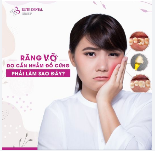 “Crack… “ Răng vỡ do cắn nhầm đồ cứng, phải làm sao đây