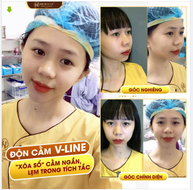Cứ bị mê mẩn luôn ý, cằm vừa làm xong: ƯNG LẮM NÈ